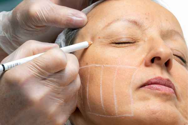 CryoPen: 5 Skin Concerns It May Be Used to Treat 4 What should you ask before having CryoPen treatment Littleport?